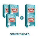 Facetas Dentárias Naturais Removíveis PerfetctSmile One | Seu sorriso perfeito em poucos minutos