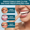 Facetas Dentárias Naturais Removíveis PerfetctSmile One | Seu sorriso perfeito em poucos minutos